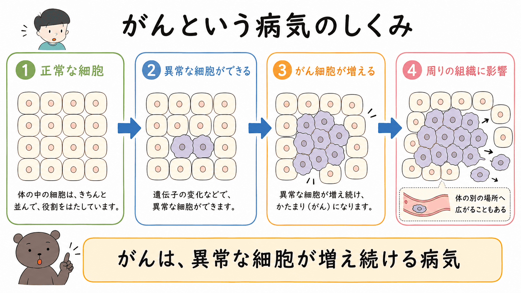 正常な細胞が異常な細胞に変化し、がん細胞が増えて周りの組織に広がる流れを示した図解